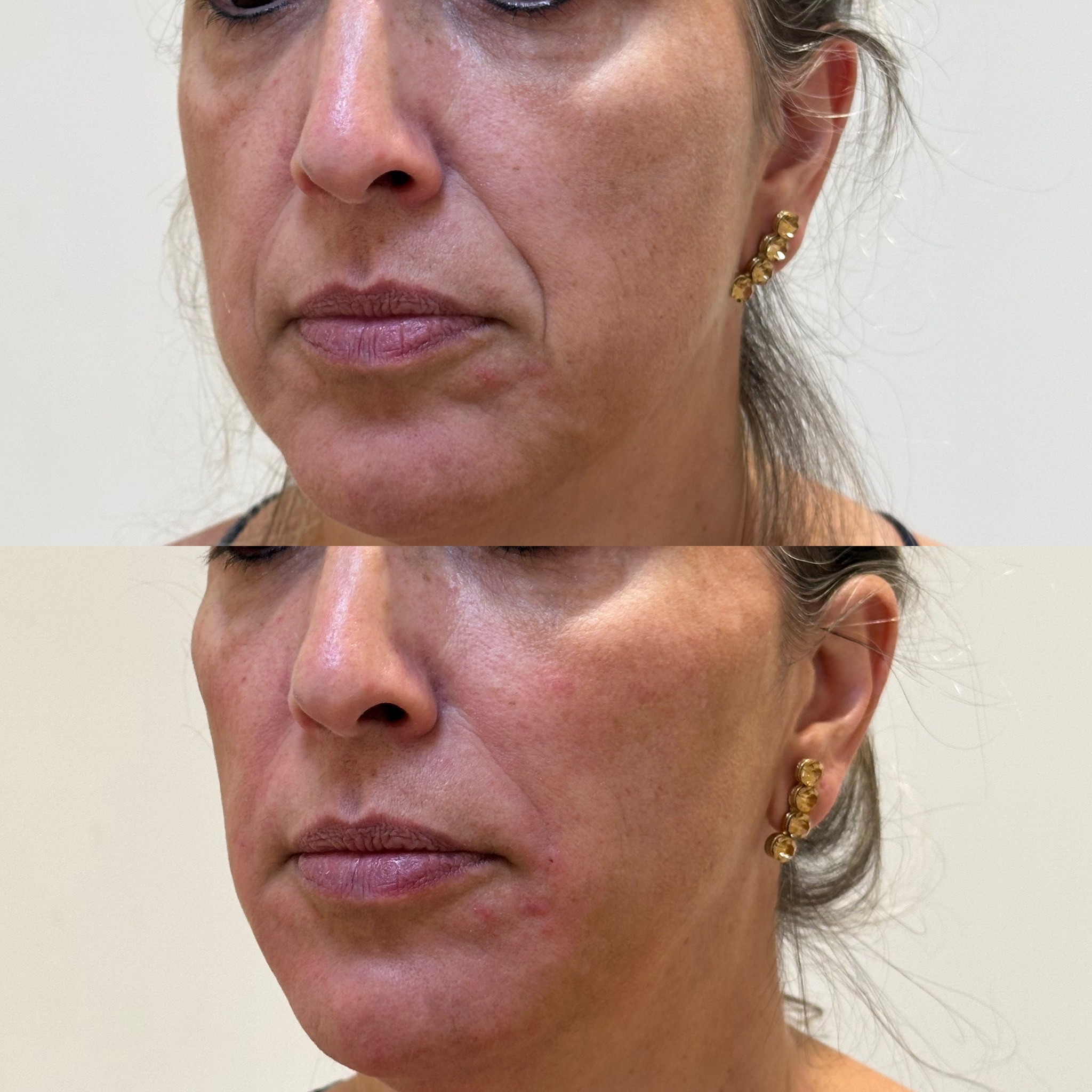 BIGODE CHINES-DZORZI