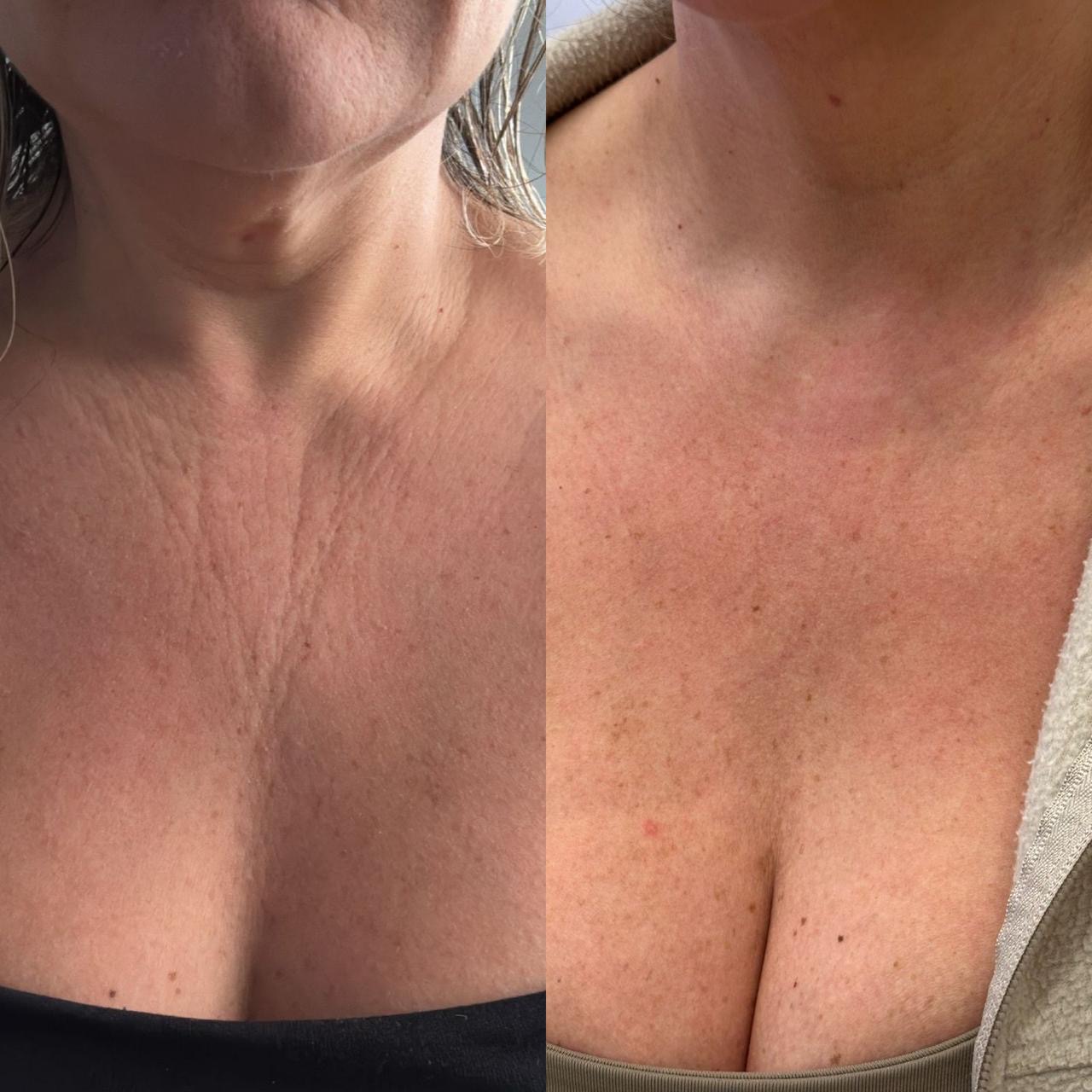 LINHAS DO COLO - DZORZI