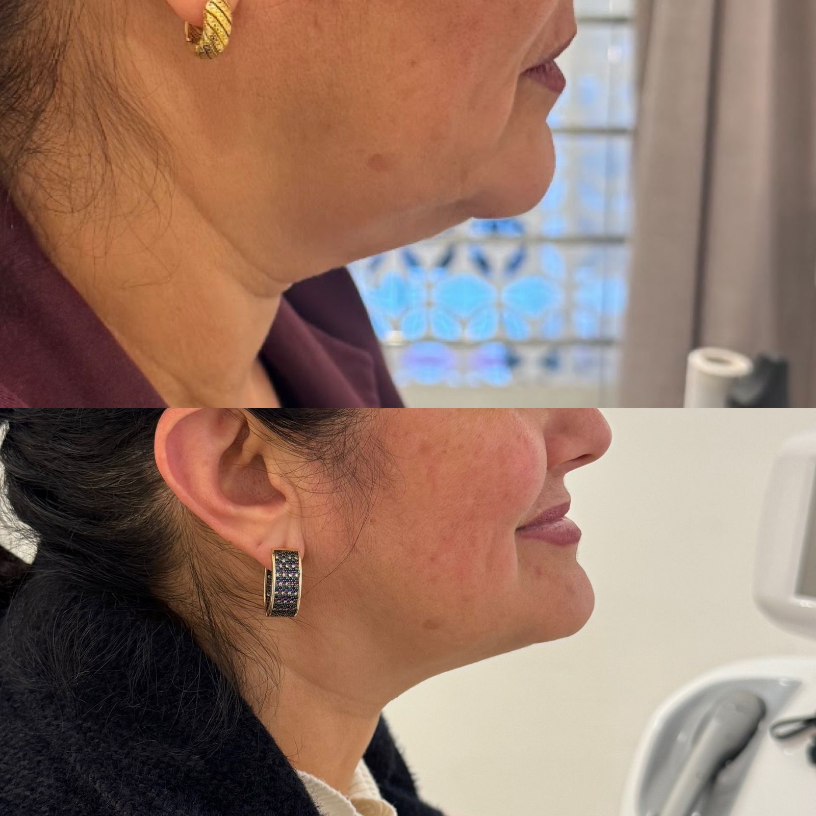 PAPADA-ULTRAFORMER-DZORZI.1