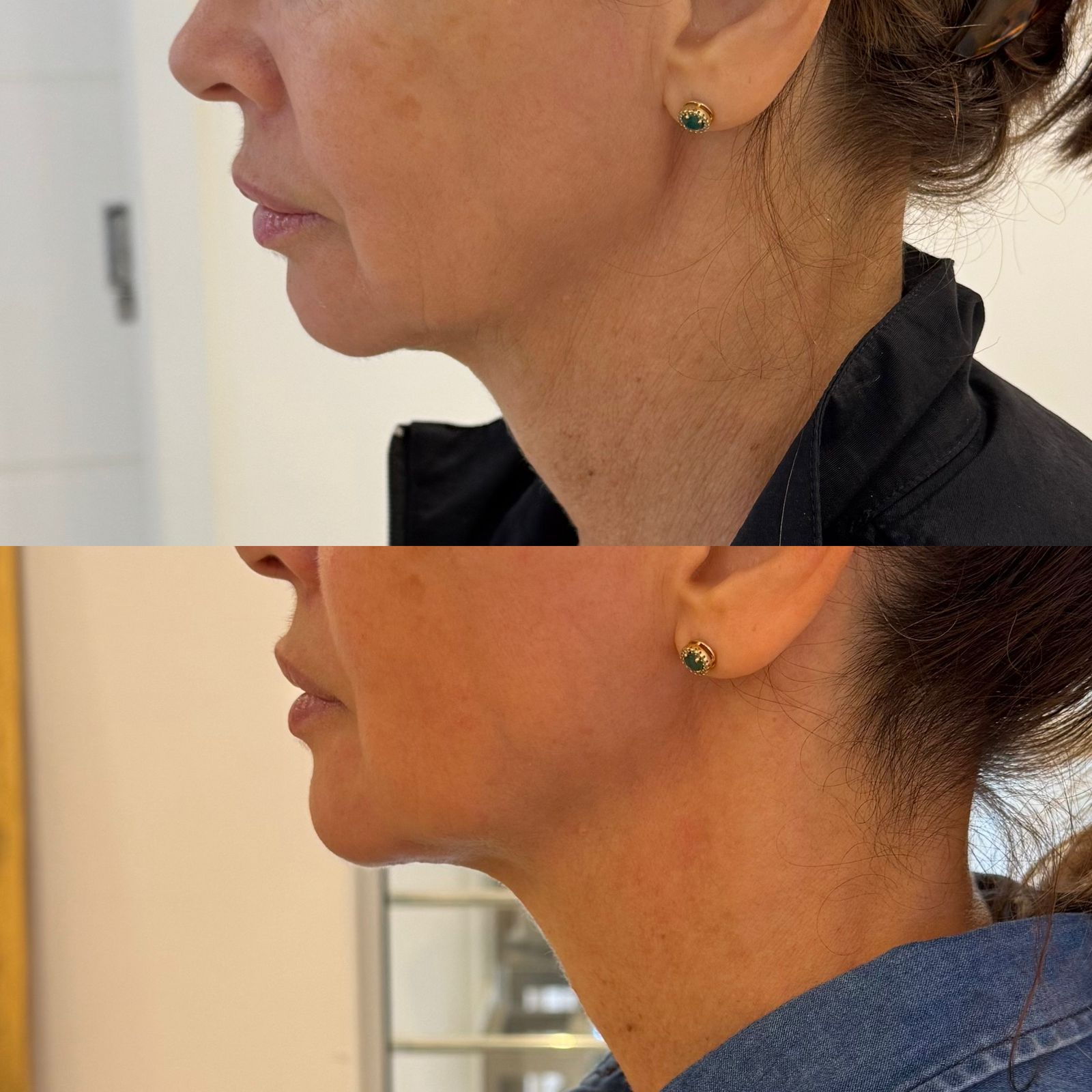 PAPADA-ULTRAFORMER-DZORZI.3