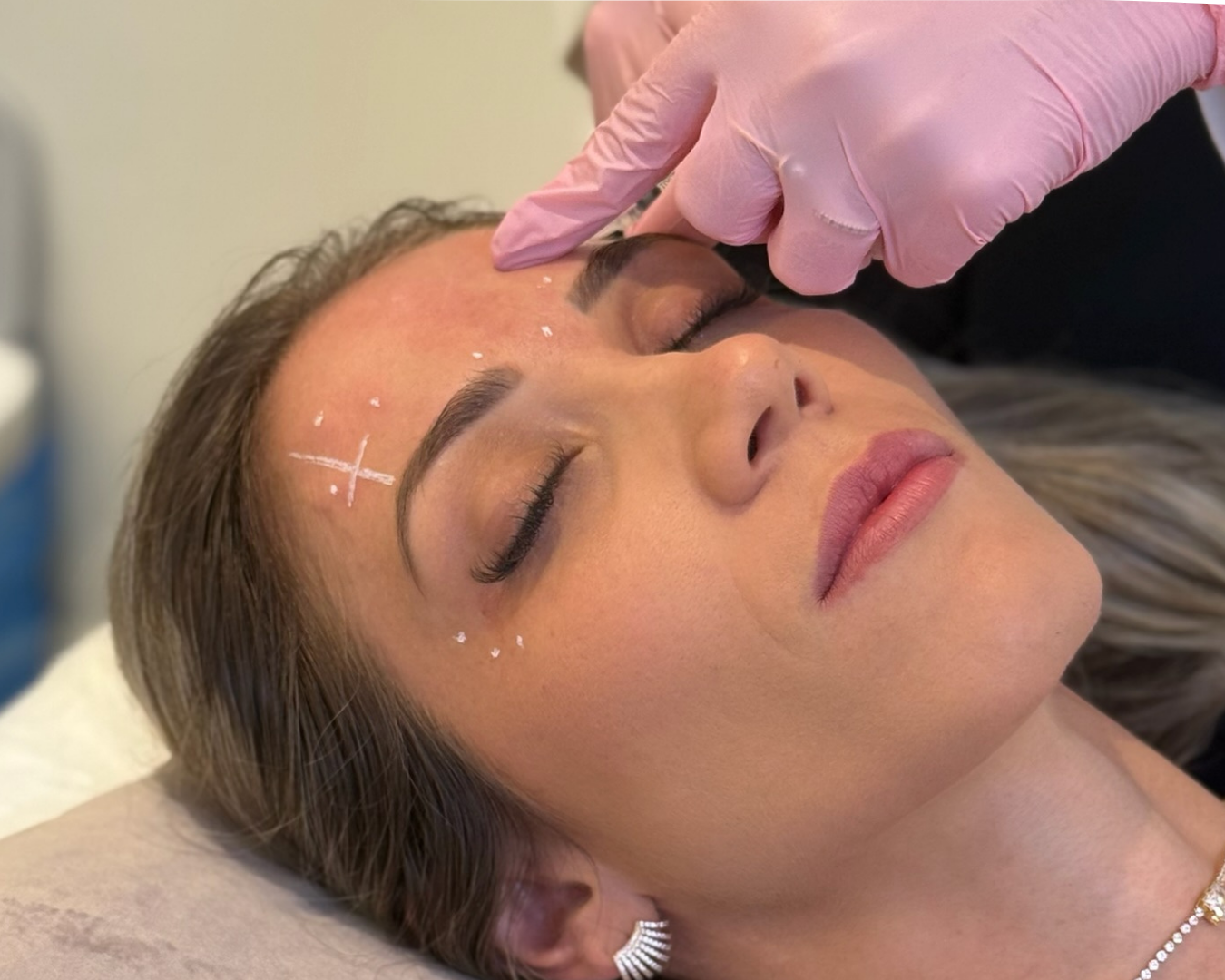 Toxina Botulinica Dzorzi 2026